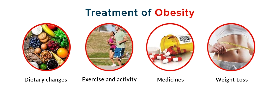 Treatment of Obesity